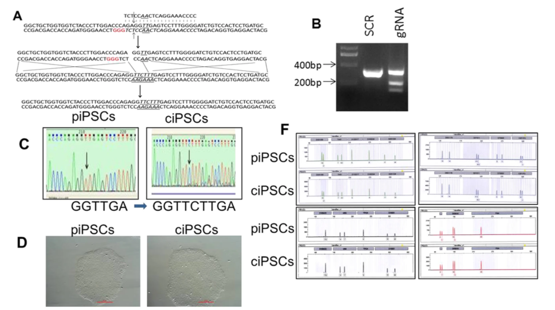 对患者来源的ips细胞进行CRISPR/Cas9基因编辑，矫正β-珠蛋白的HBB基因点突变
