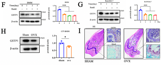 GSTP1对骨密度的影响通过破骨细胞实现