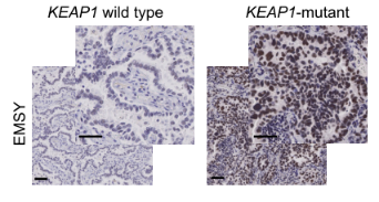 KEAP1基因突变引起EMSY的累积