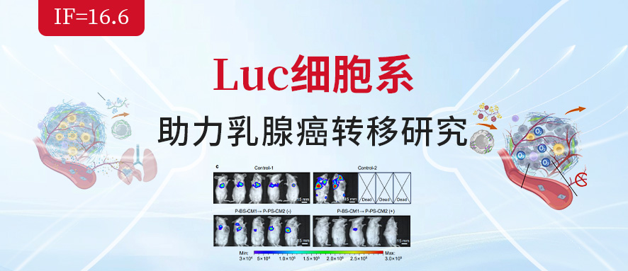 IF=16.6|源井4T1-Luc细胞系助力弥散性乳腺癌转移研究