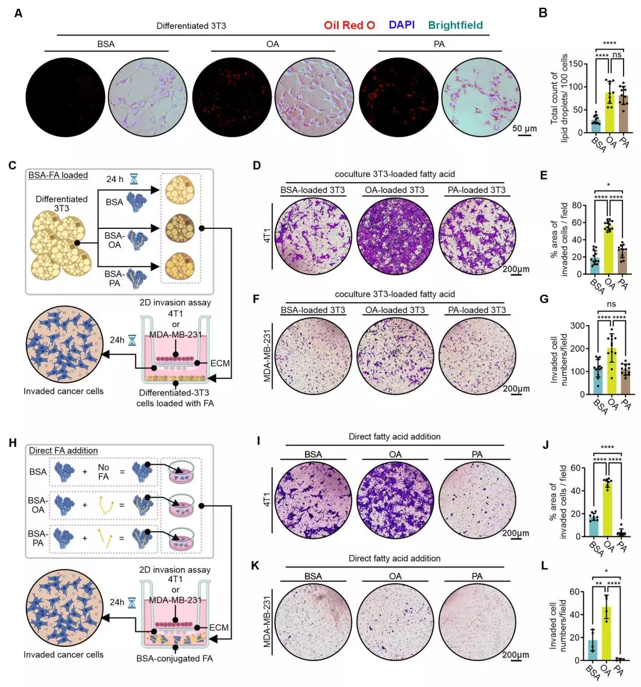 图四：油酸在体外直接促进TNBC细胞侵袭