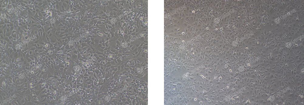 Hep 3B 细胞正常状态