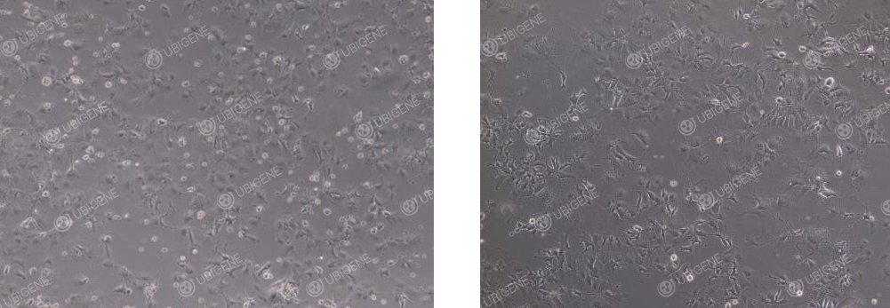 ep 3B 细胞异常状态