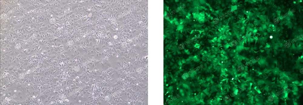 慢病毒感染后的细胞图片
