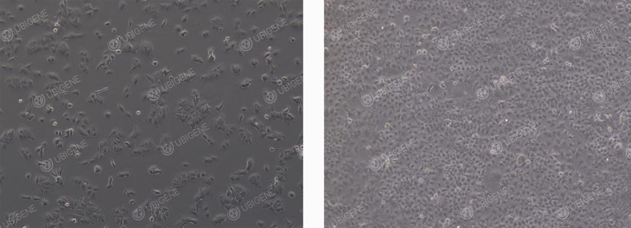 HuH-7细胞正常状态