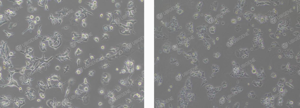 HuH-7细胞异常状态
