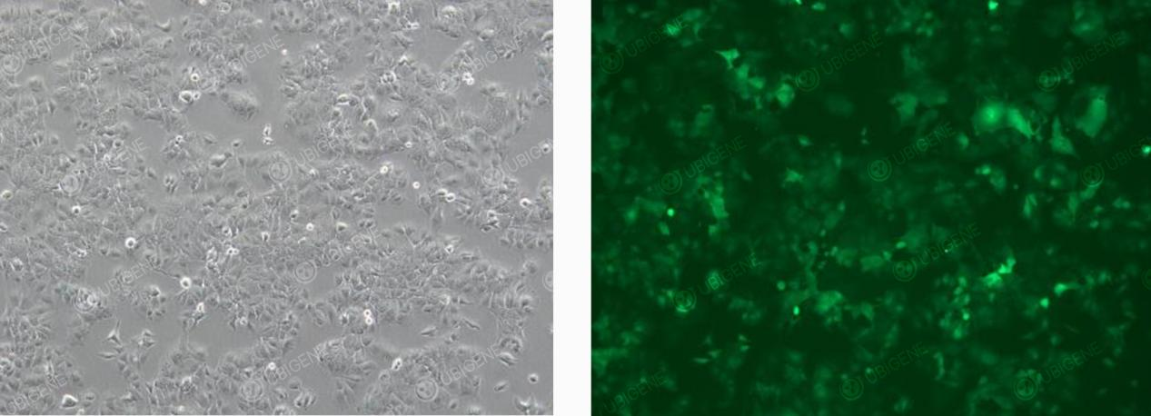 慢病毒感染后的细胞图片