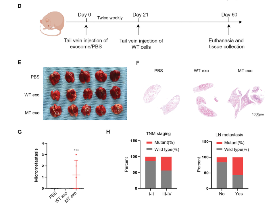 图4 外泌体PIK3CA H1047R突变与结直肠癌转移相关