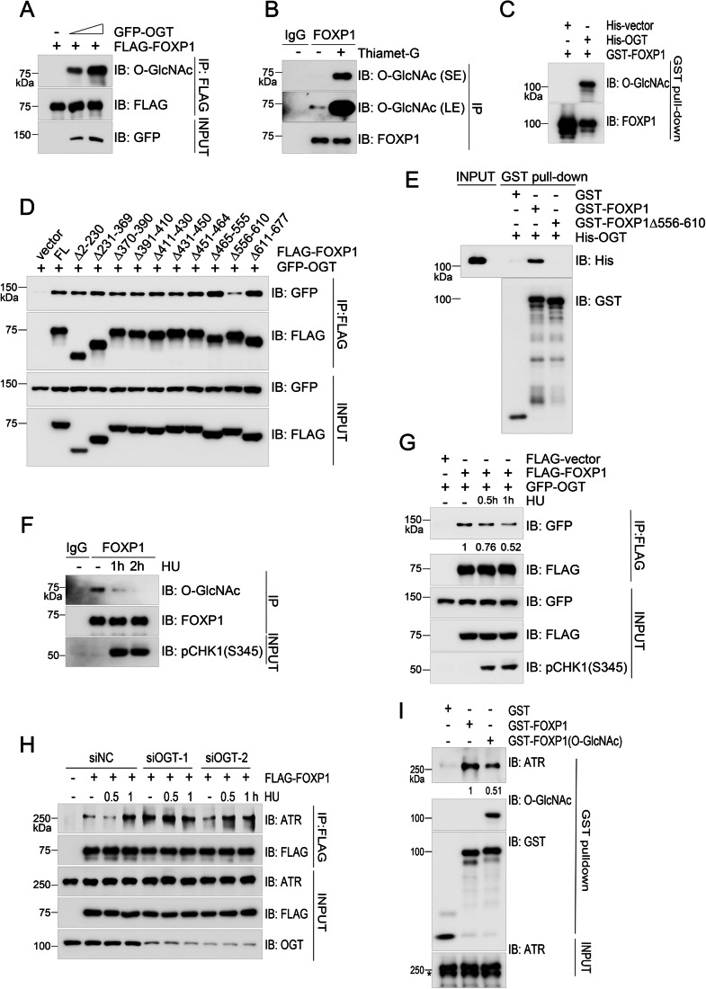 图4、OGT介导的FOXP1O-GlcNAcylation修饰抑制其与ATR的相互作用
