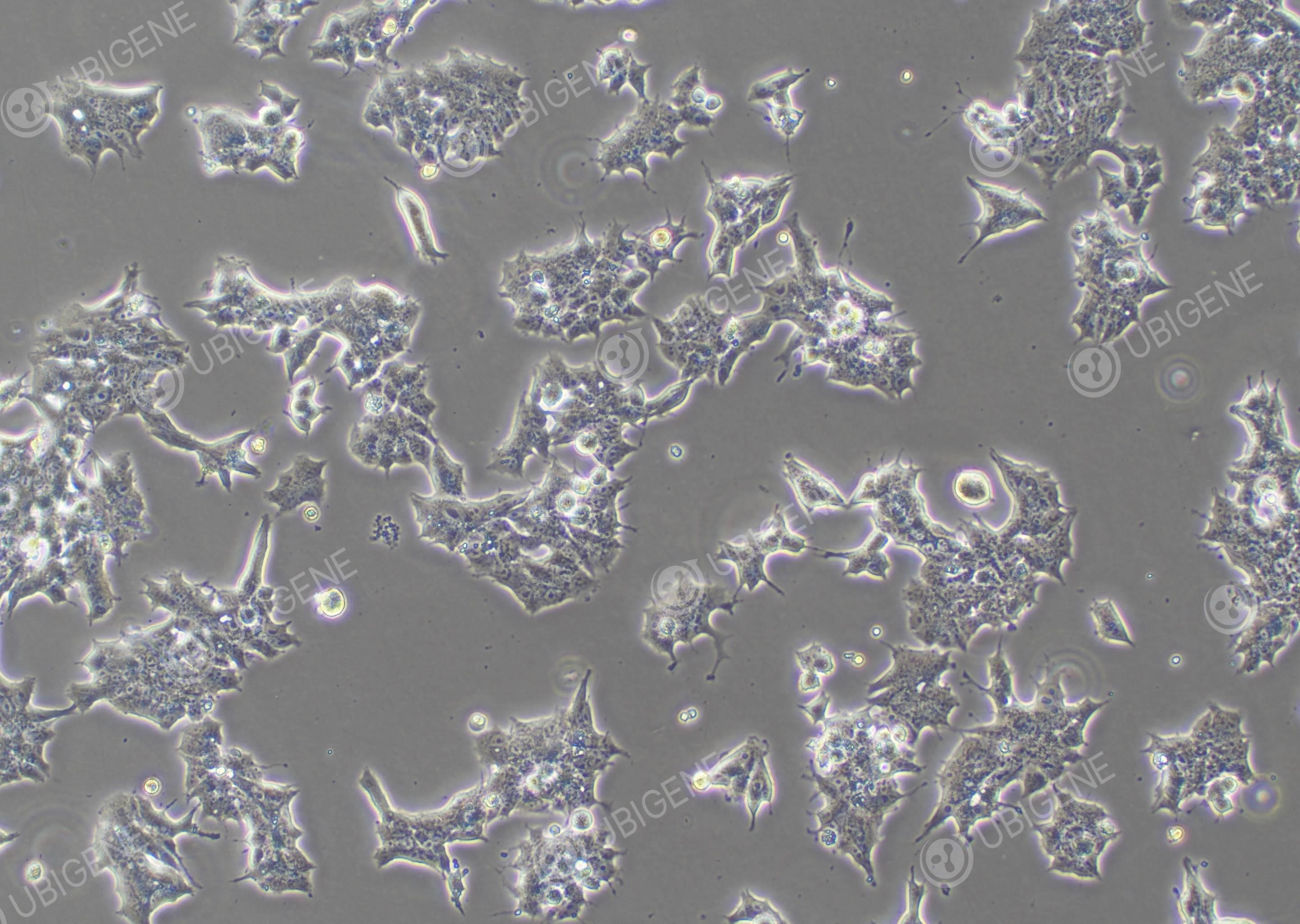 人前列腺癌细胞(22RV1-CAS9)-22RV1