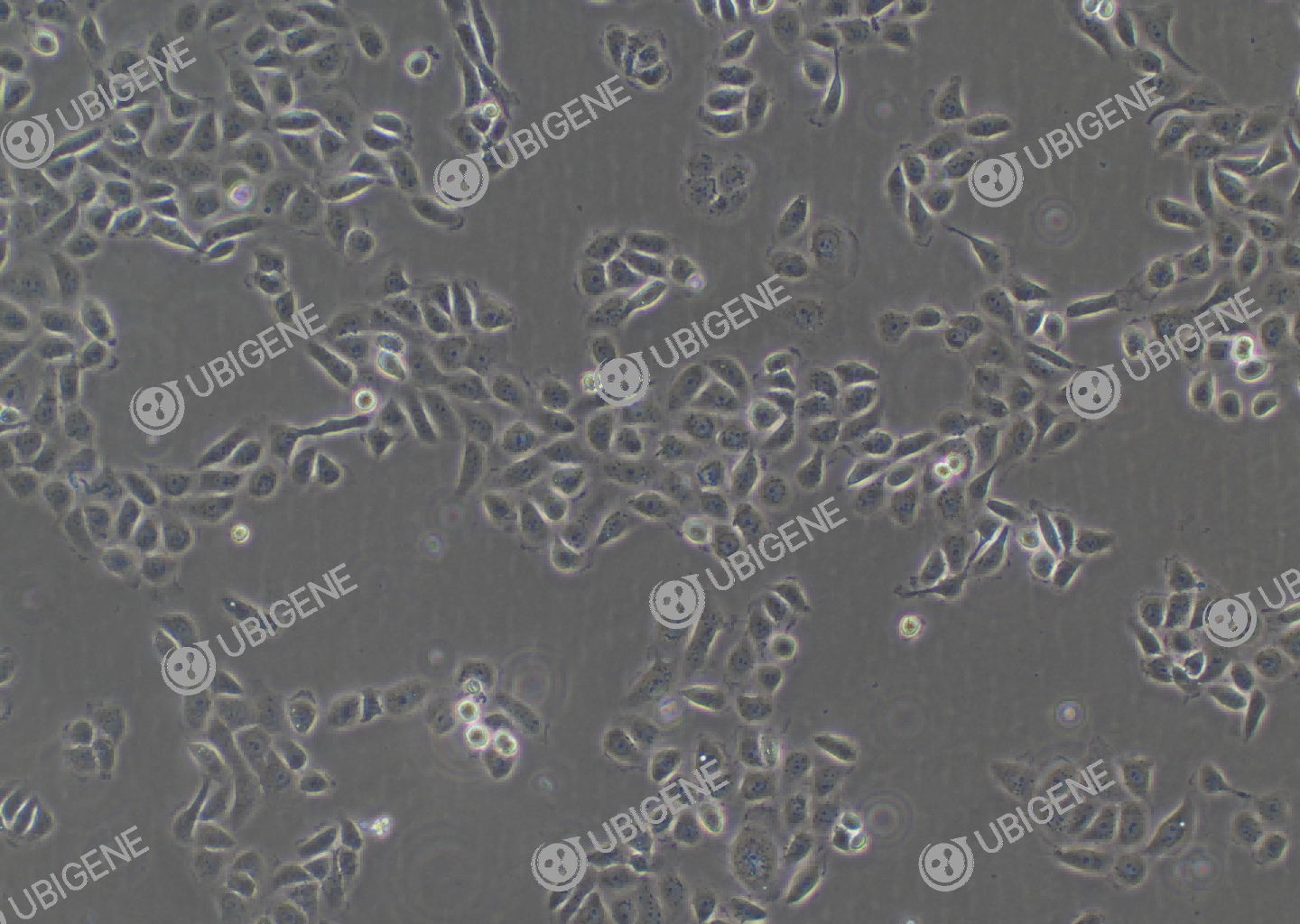 人膀胱癌细胞(5637)细胞形态培养图