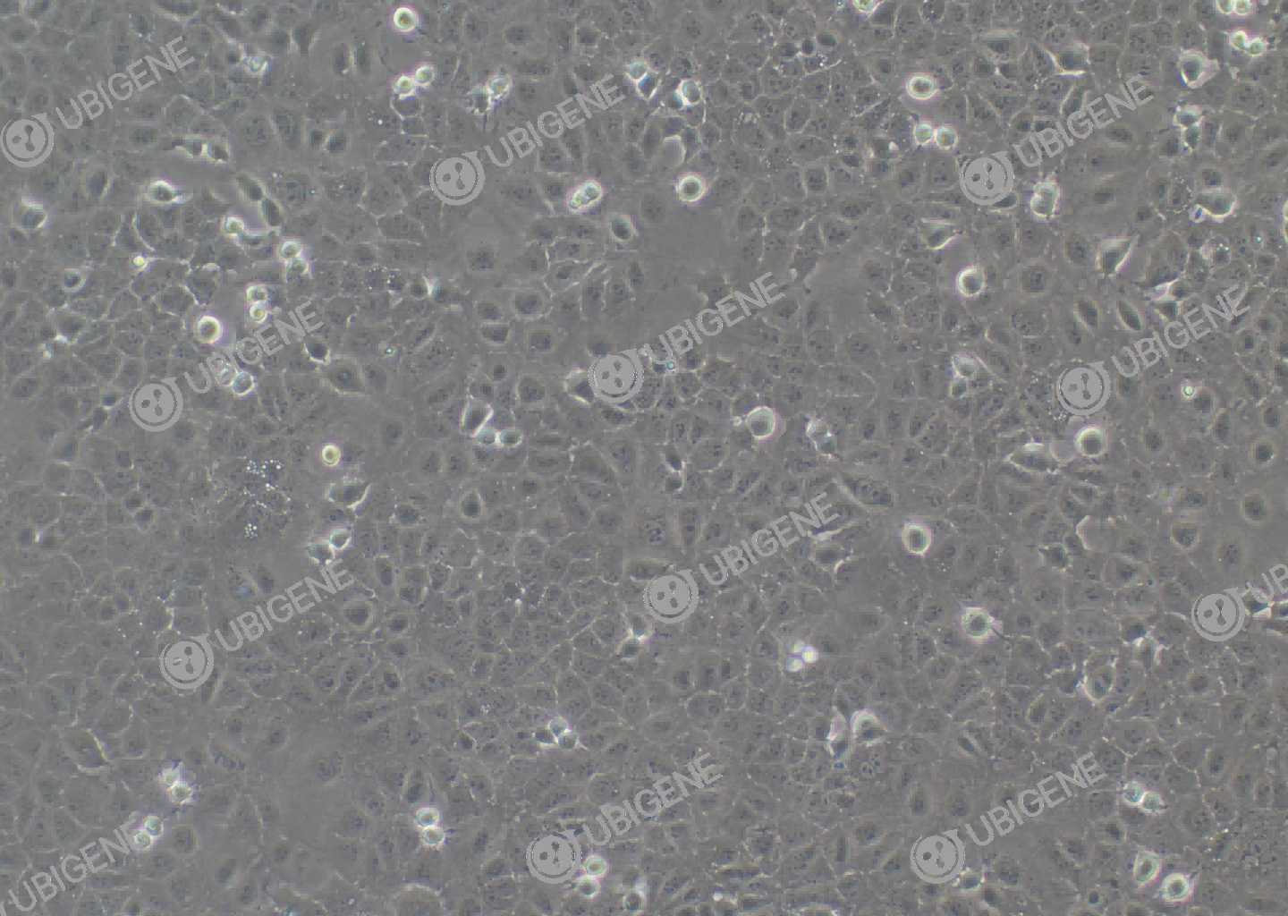 小鼠正常肝细胞(AML12)细胞形态培养图