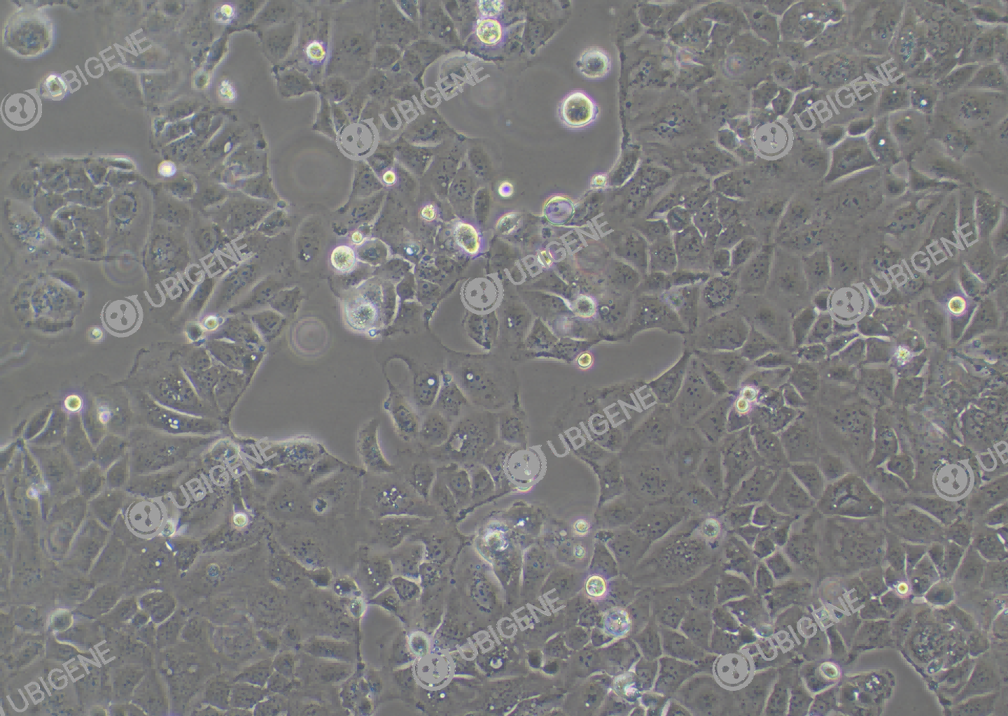人结直肠腺癌细胞(Caco-2)细胞形态培养图