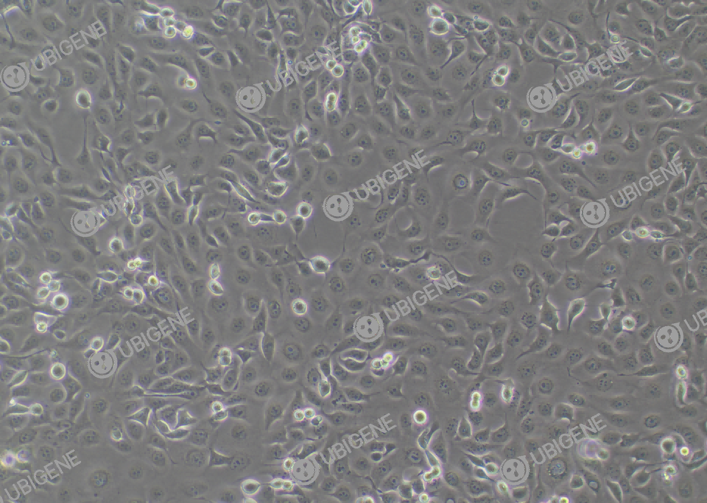 人角膜上皮细胞(HCE-T)细胞形态培养图