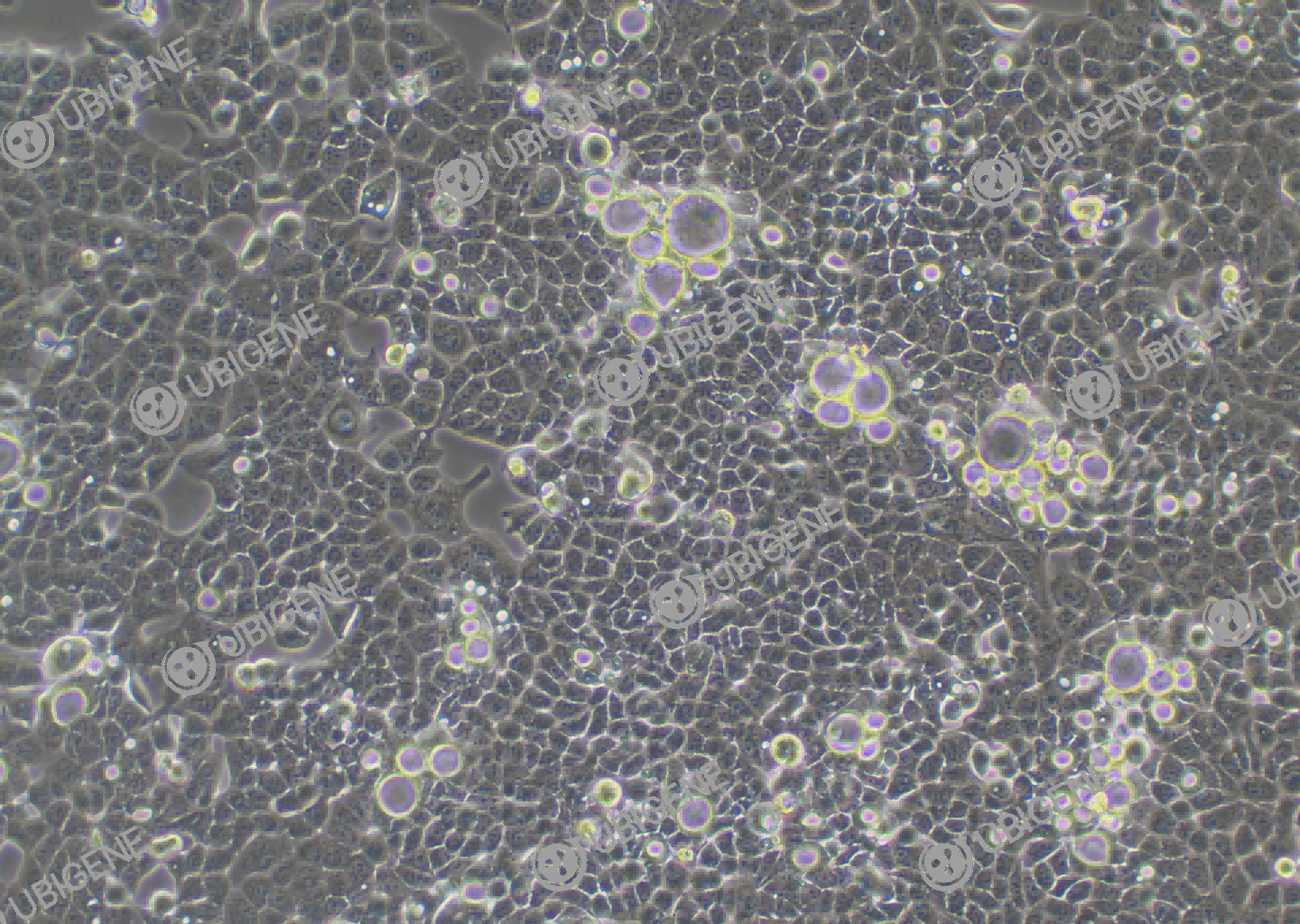 人子宫腺癌细胞(HEC-1-B)细胞形态培养图