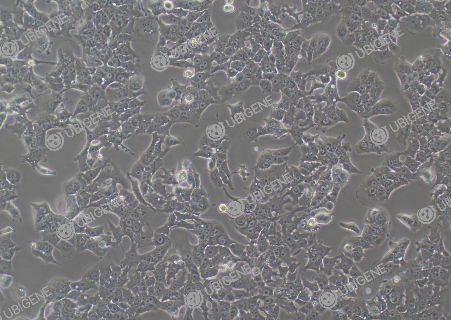 小鼠肝癌细胞(Hepa 1-6)细胞形态培养图