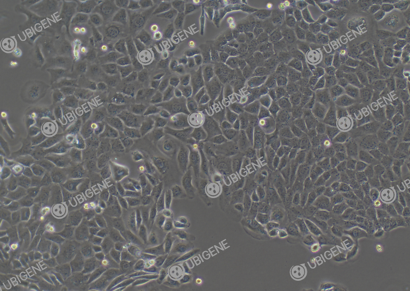 小鼠卵巢上皮癌细胞(ID8)细胞形态培养图