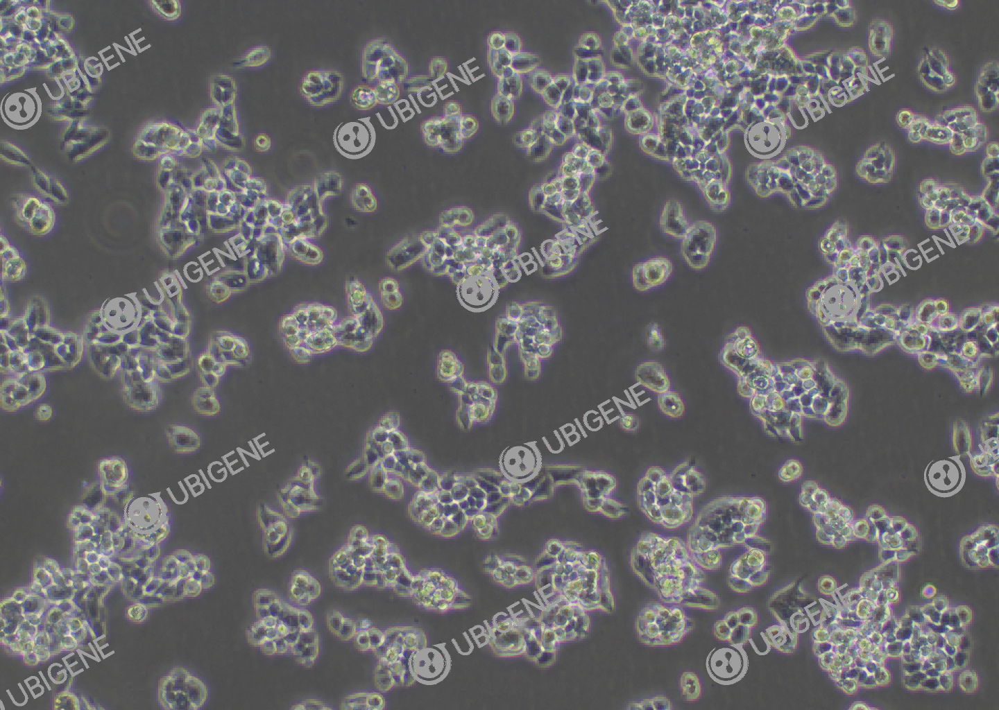 人结直肠腺癌细胞(LS 174T)细胞形态培养图