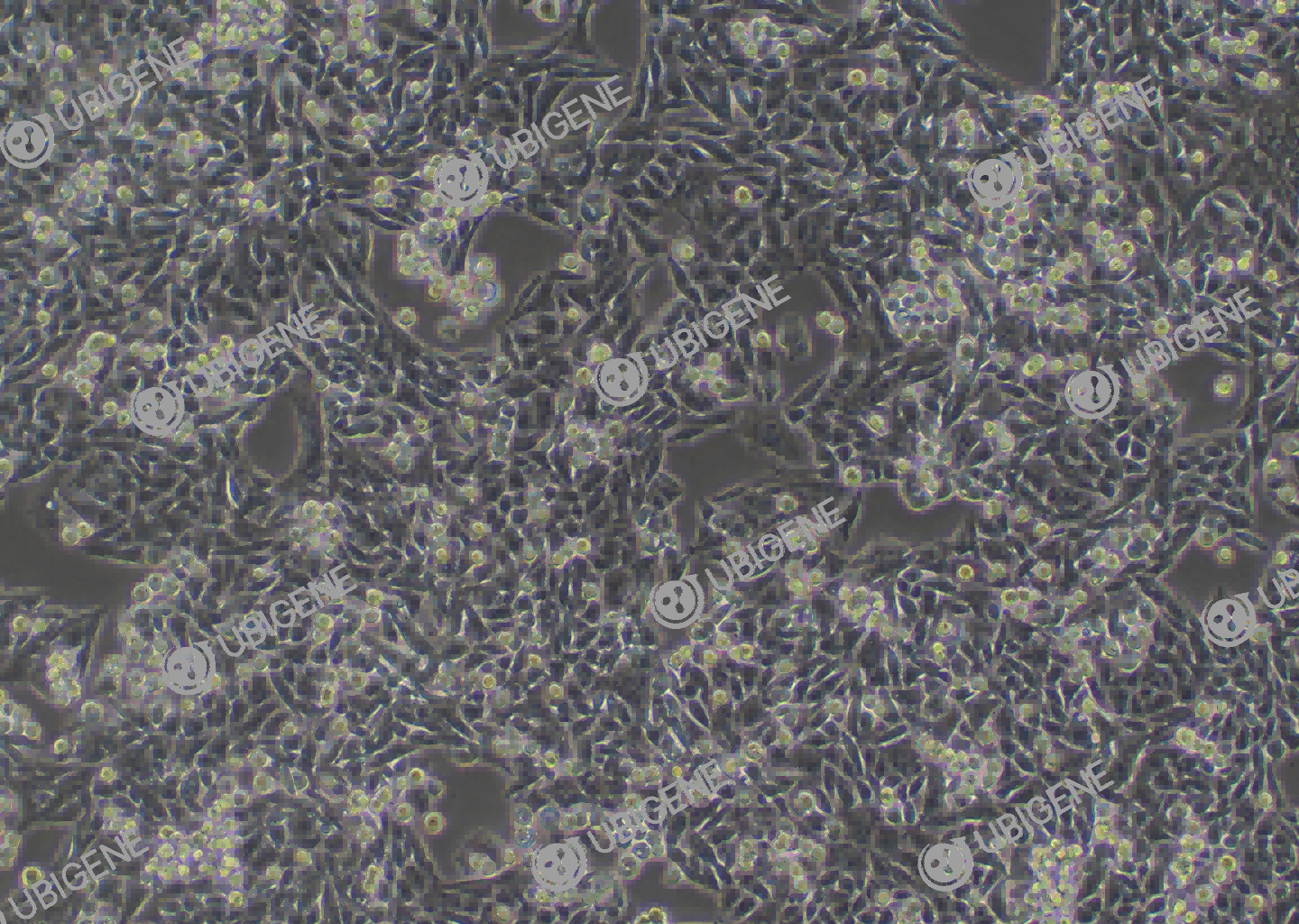 小鼠膀胱癌细胞(MB-49)细胞形态培养图