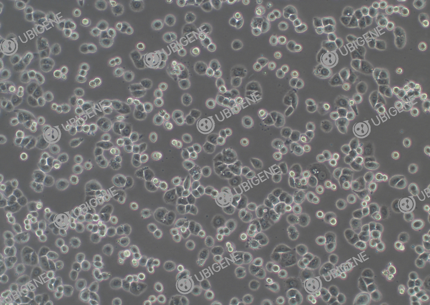 人乳腺腺癌细胞(MDA-MB-468)细胞形态培养图