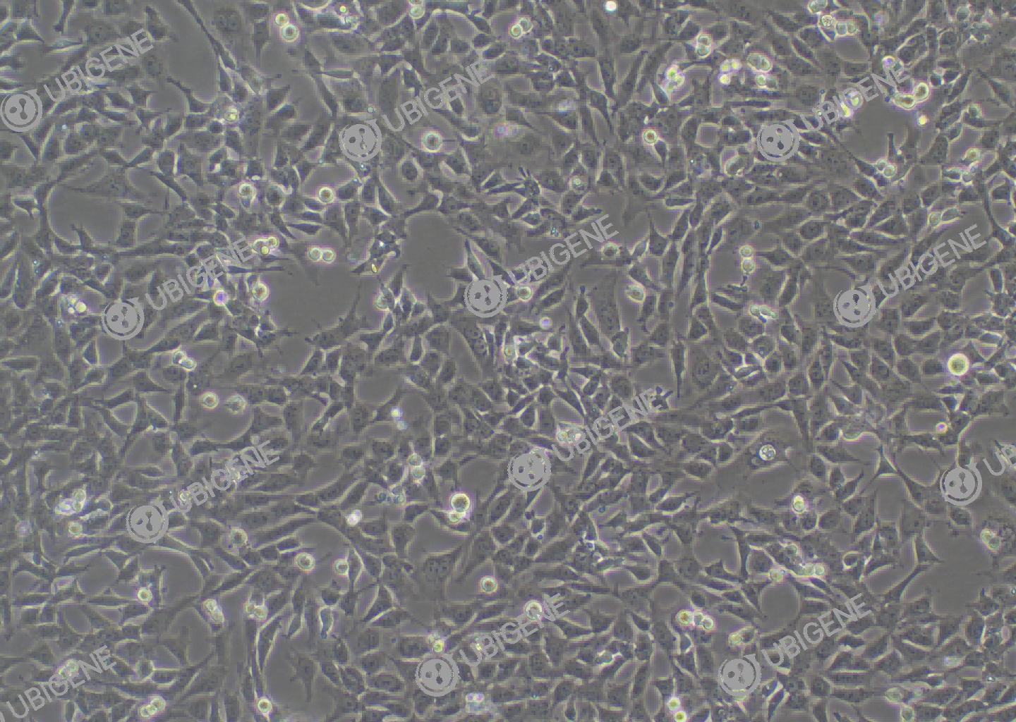 小鼠肾足细胞(MPC-5)细胞形态培养图