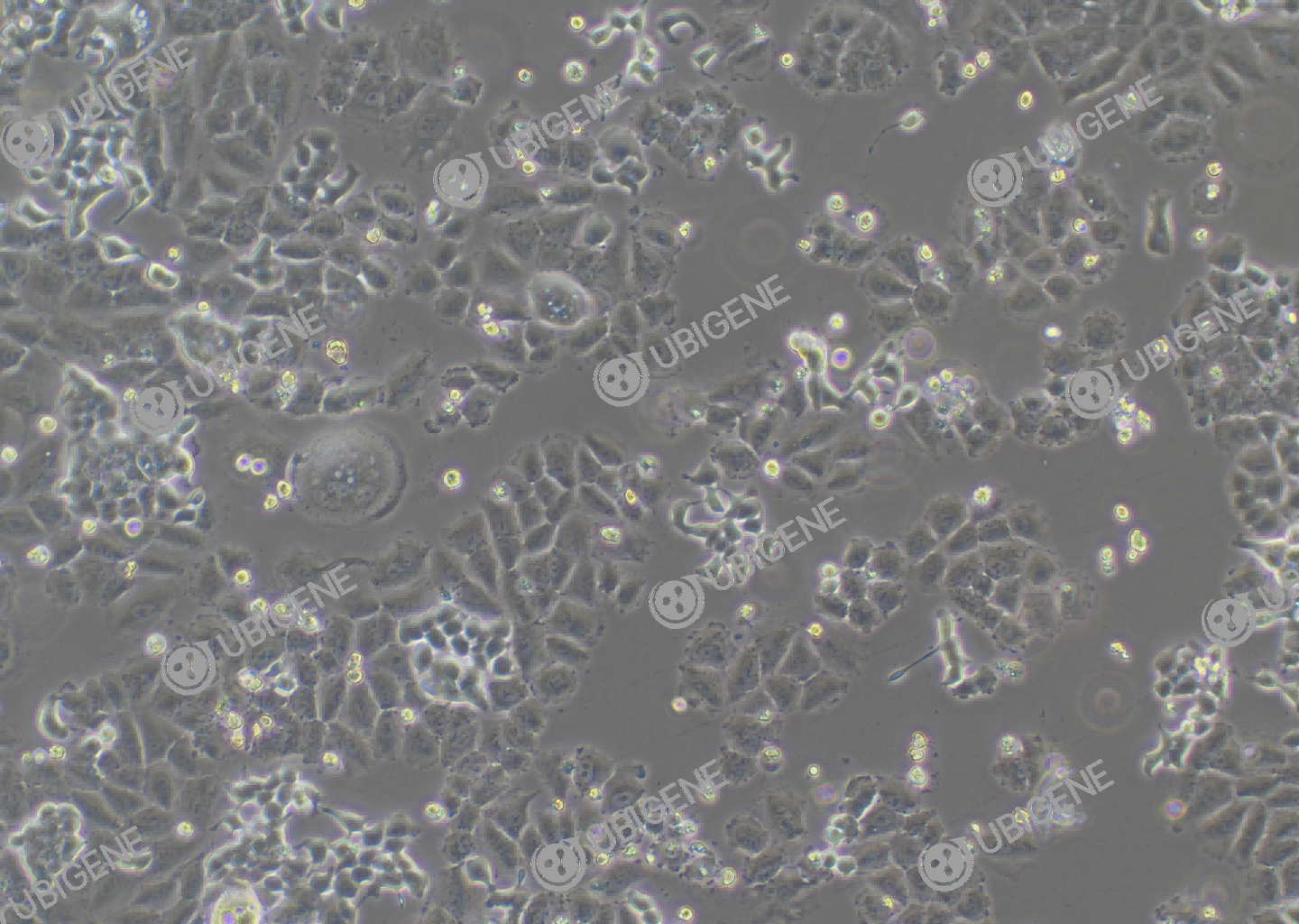 人结直肠腺癌细胞(NCI-H727)细胞形态培养图