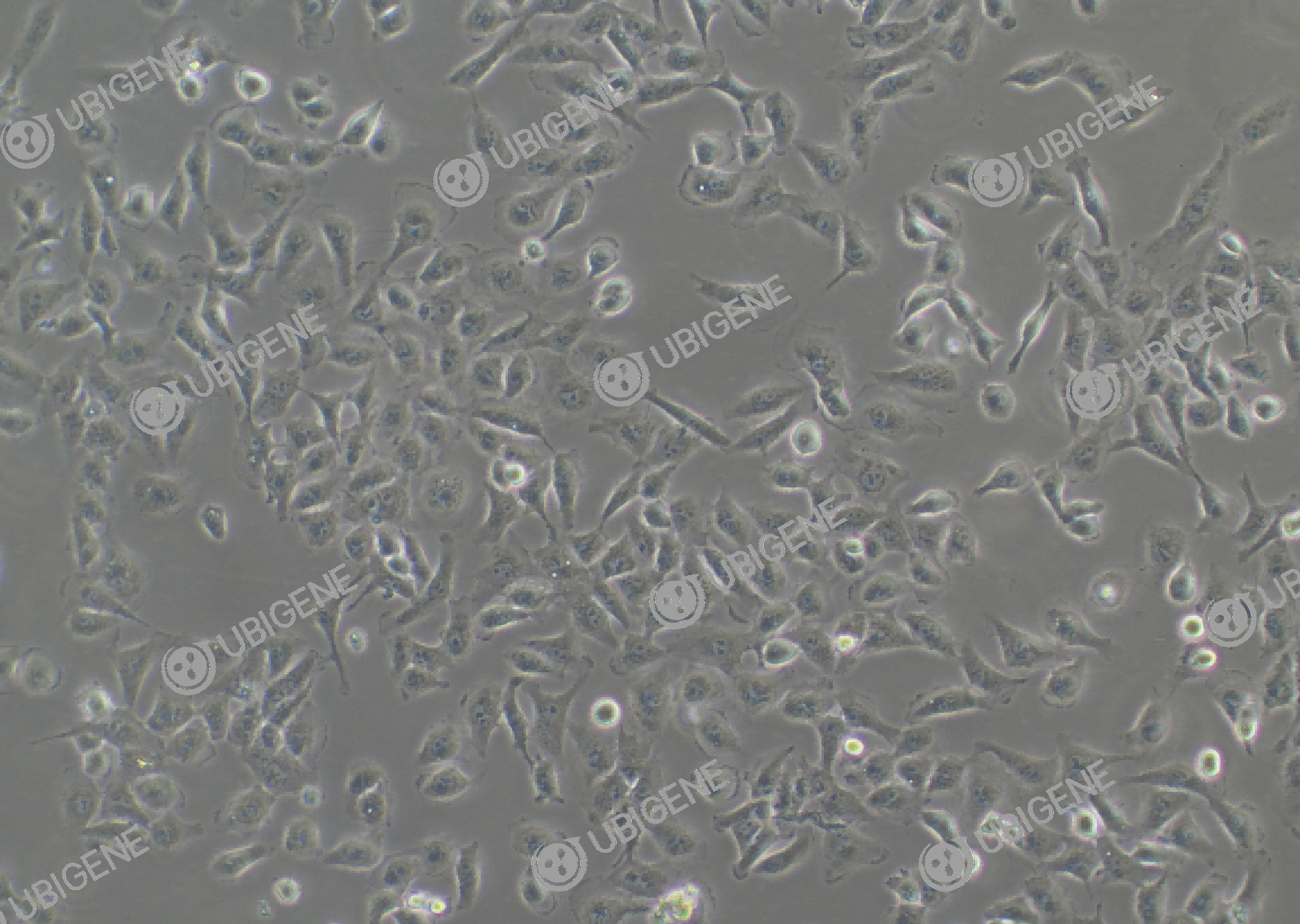 人甲状腺正常细胞(Nthy-ori 3-1)细胞形态培养图