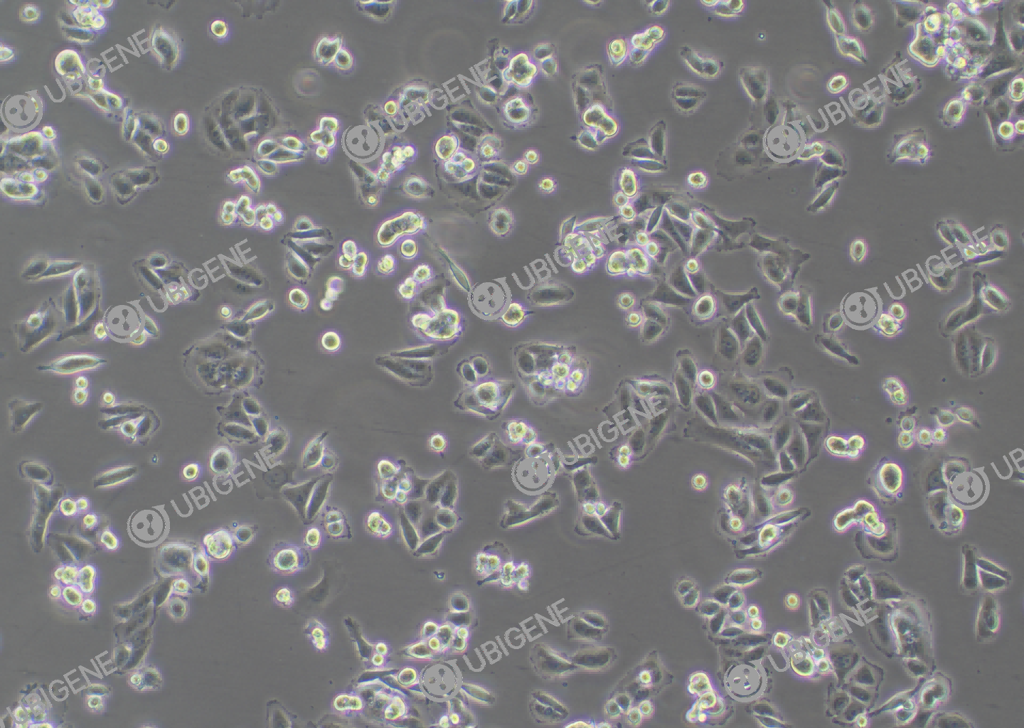 人结肠腺癌细胞(SW480)细胞形态培养图