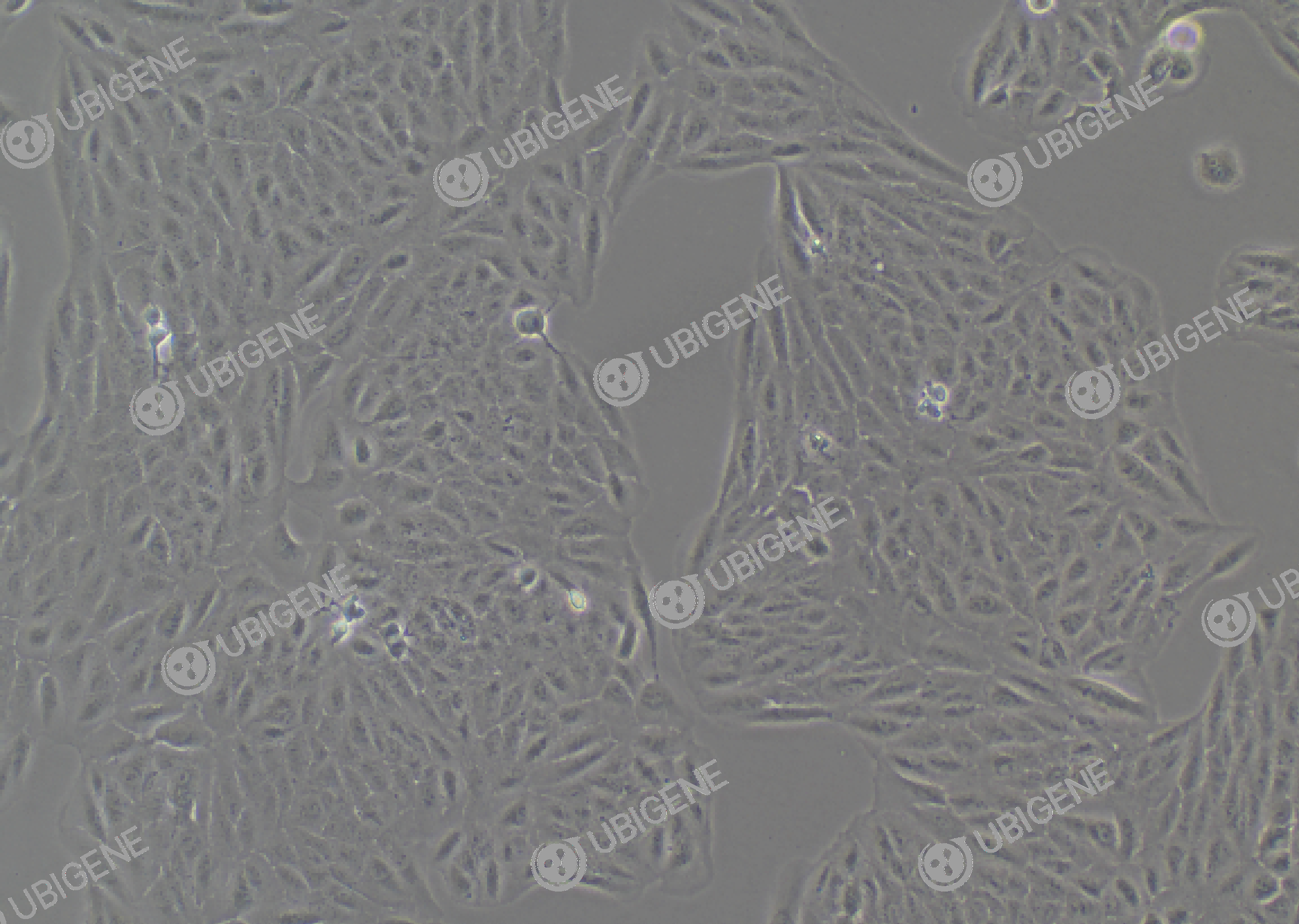 人视网膜色素上皮细胞(ARPE-19)细胞形态培养图