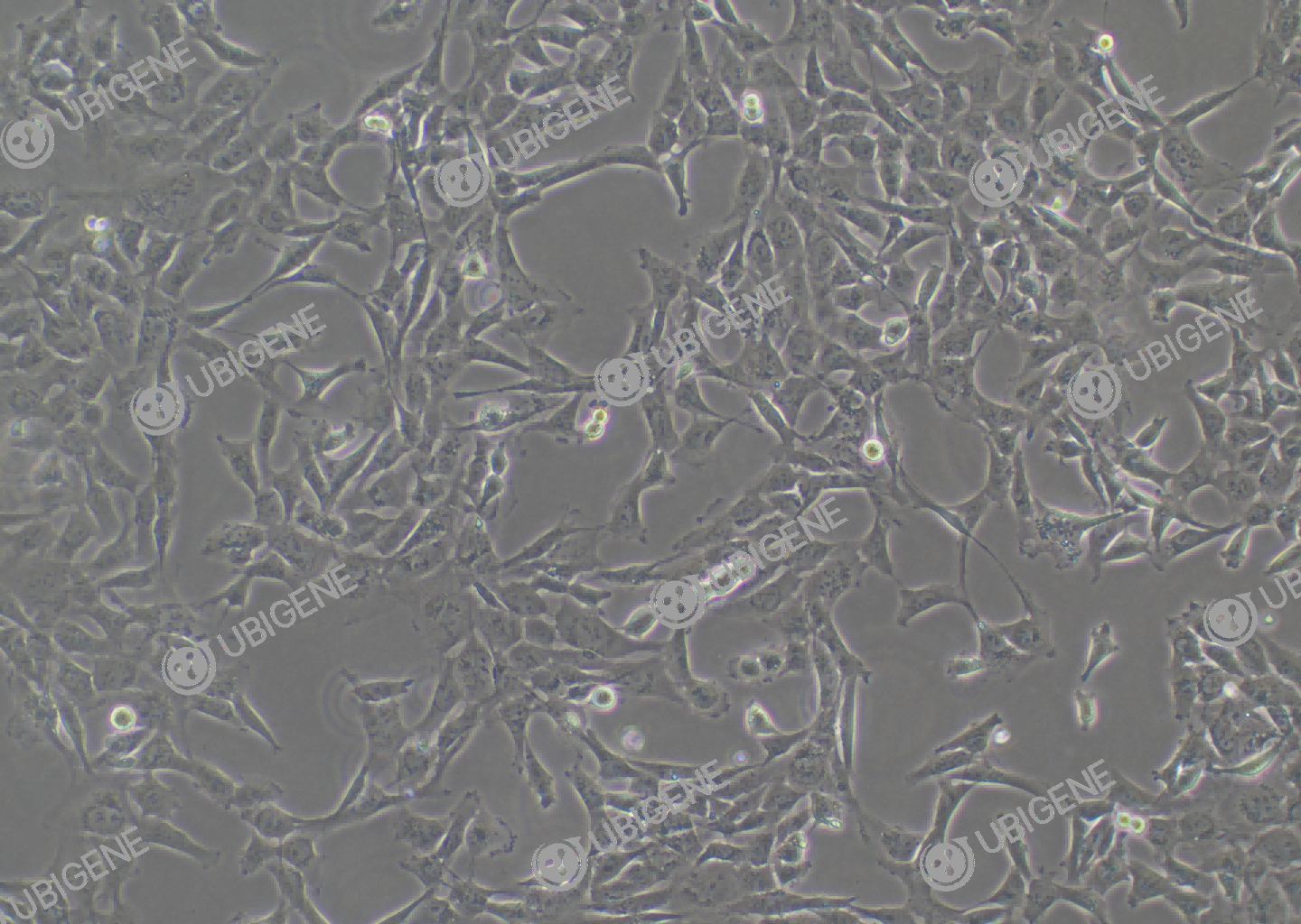 人绒毛膜滋养层细胞(HTR-8/SVneo)细胞形态培养图