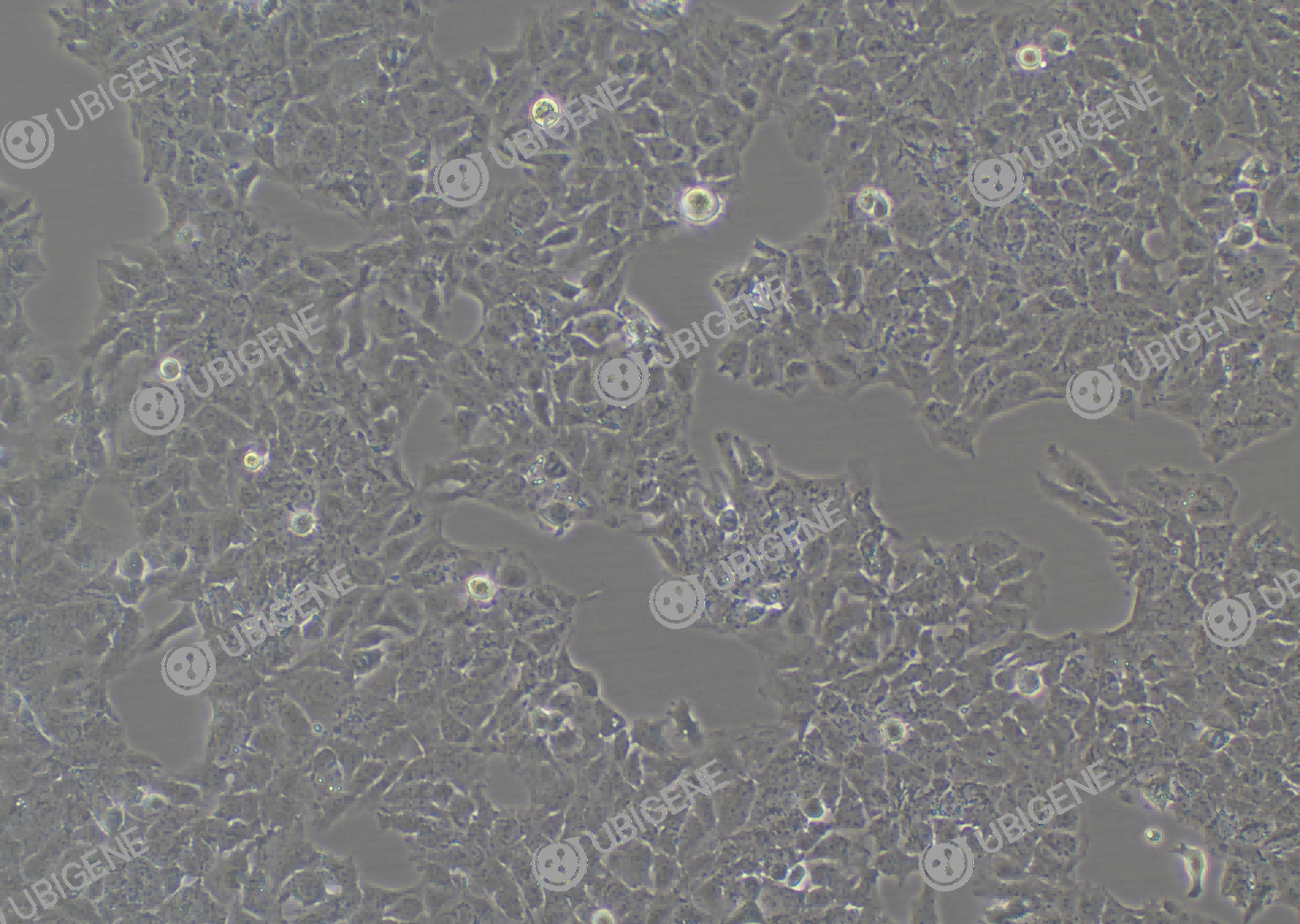 人肝癌细胞(HuH-7)细胞形态培养图