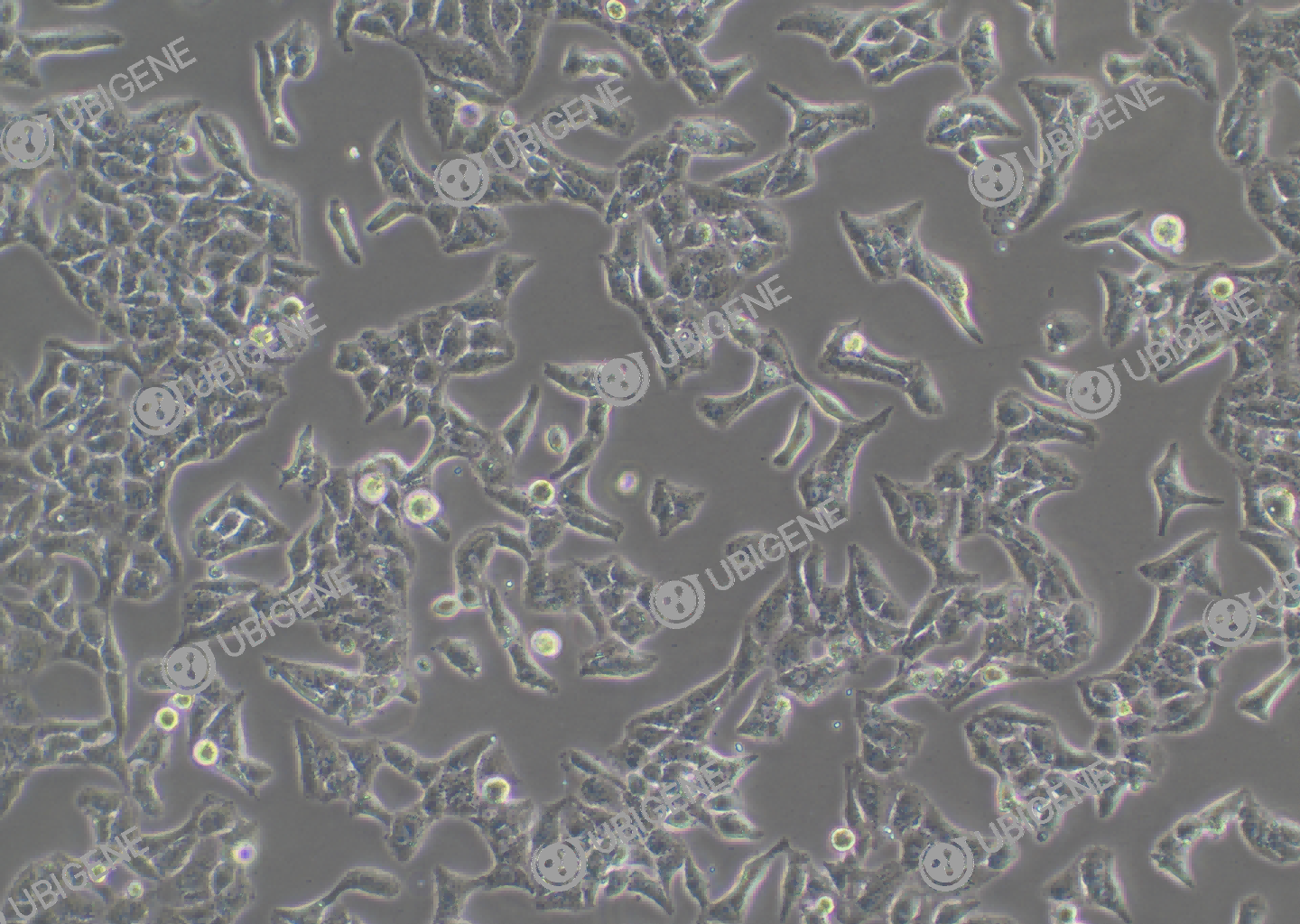 人正常肝细胞(L-02)细胞形态培养图