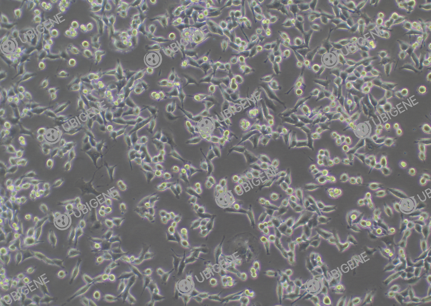 小鼠结肠癌细胞(MC38)细胞形态培养图