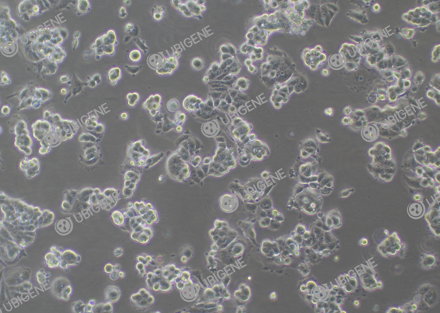 人乳腺癌细胞(MCF7)细胞形态培养图