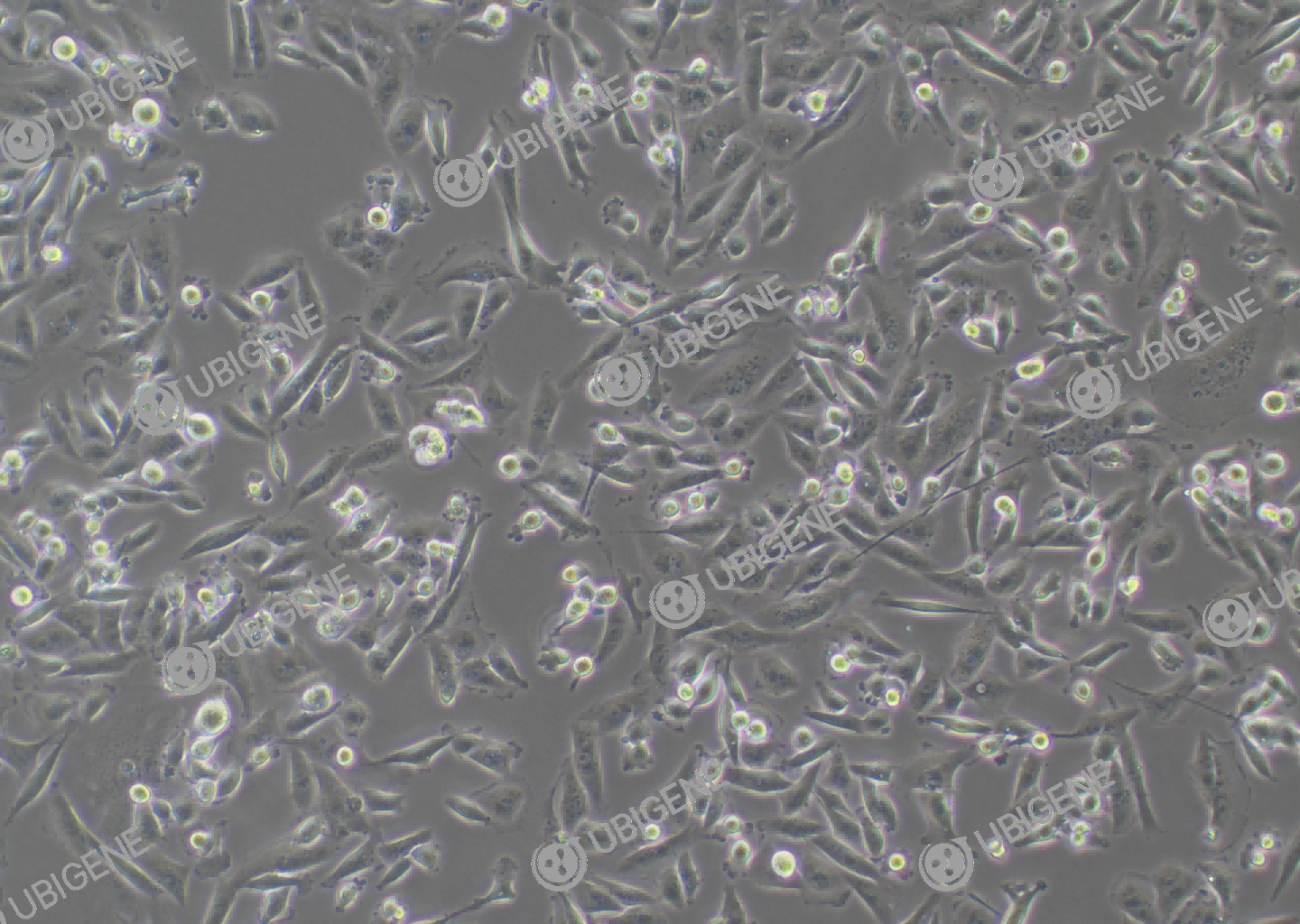 人乳腺癌细胞(MDA-MB-231)细胞形态培养图
