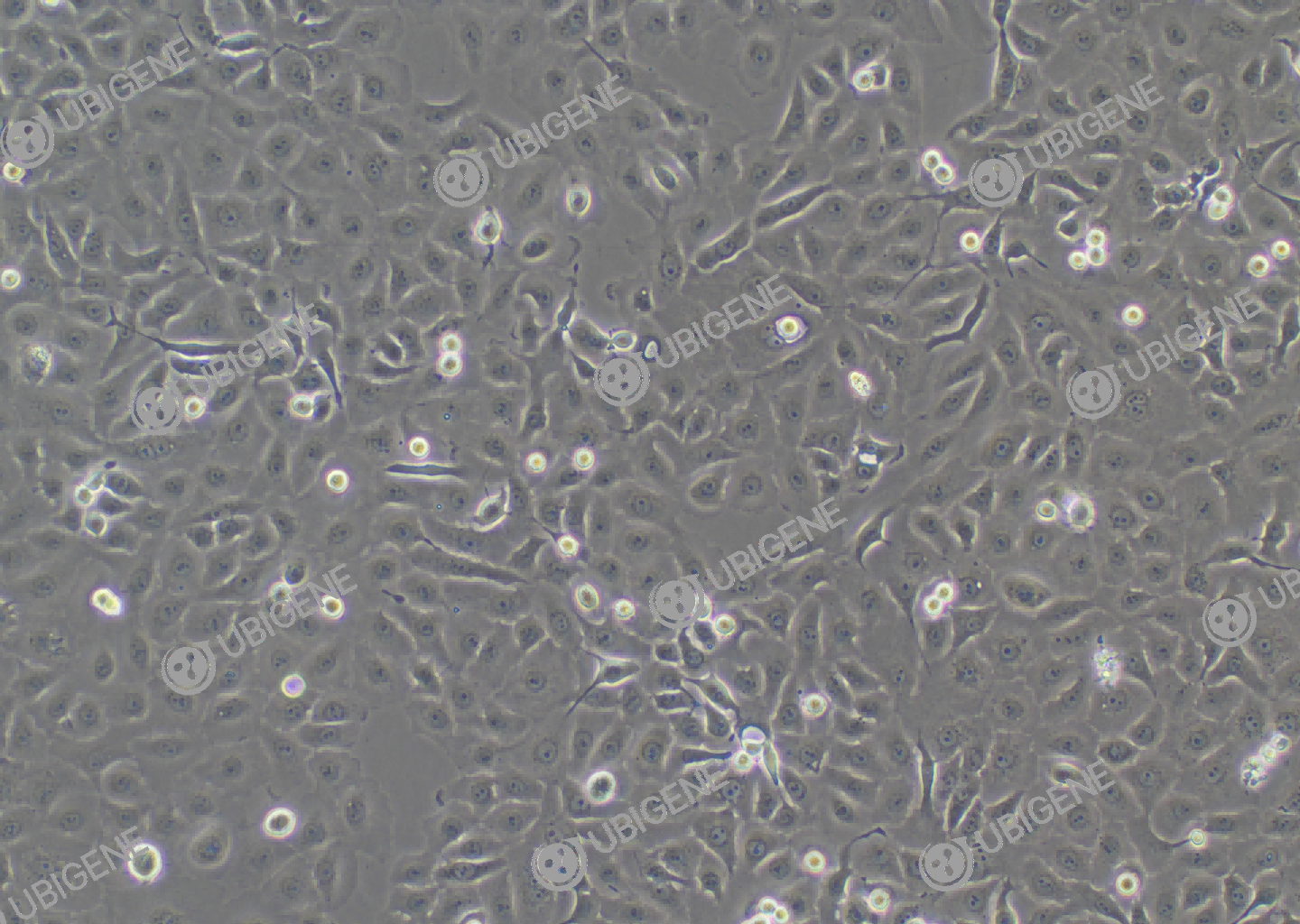 人非小细胞肺癌细胞(NCI-H1650)细胞形态培养图