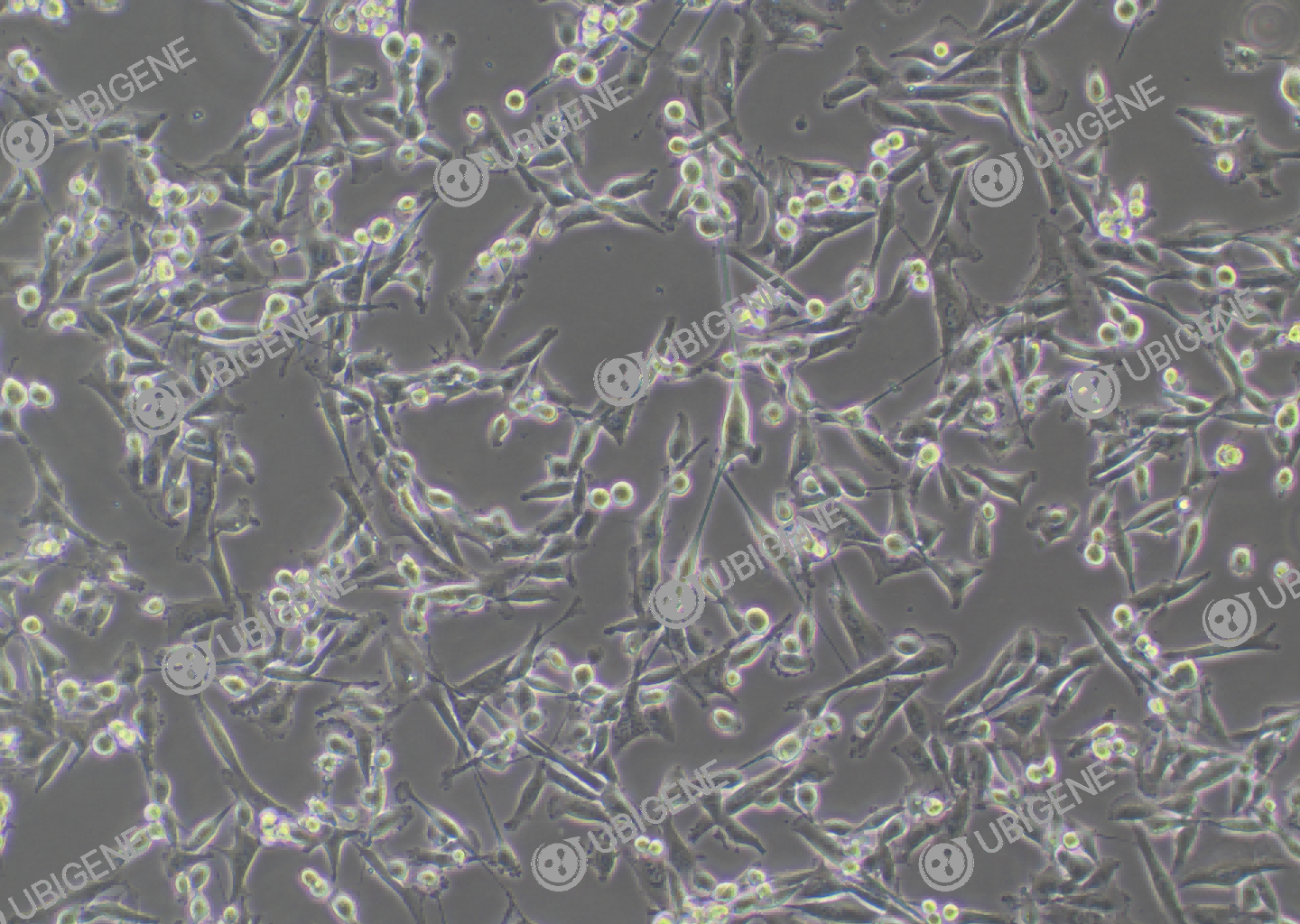 人肺腺癌细胞(NCI-H1975)细胞形态培养图