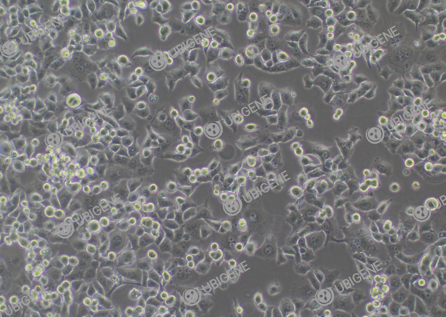人胰腺癌细胞系(Panc-1)细胞形态培养图