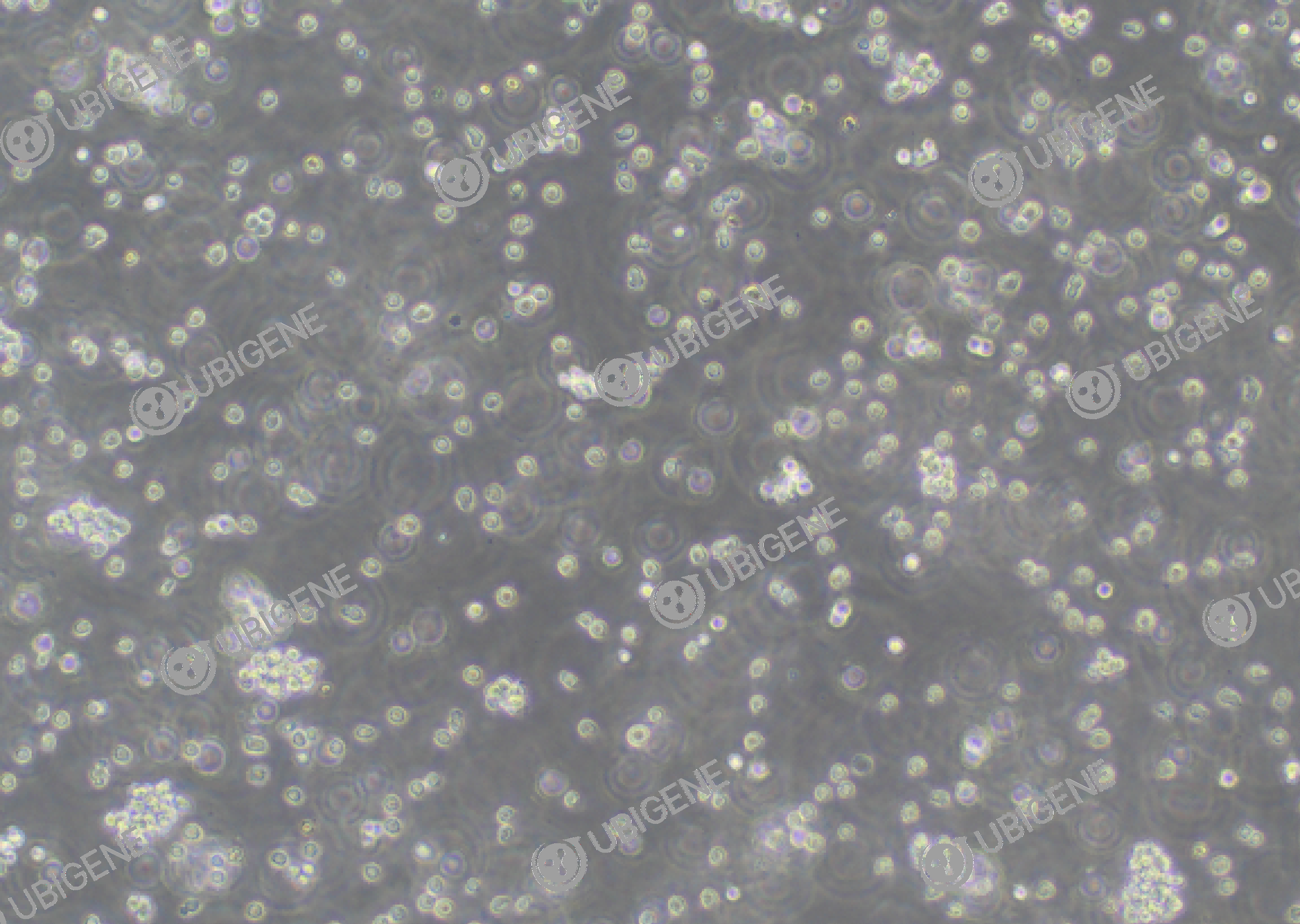 人B细胞淋巴瘤细胞(U-2932)细胞形态培养图