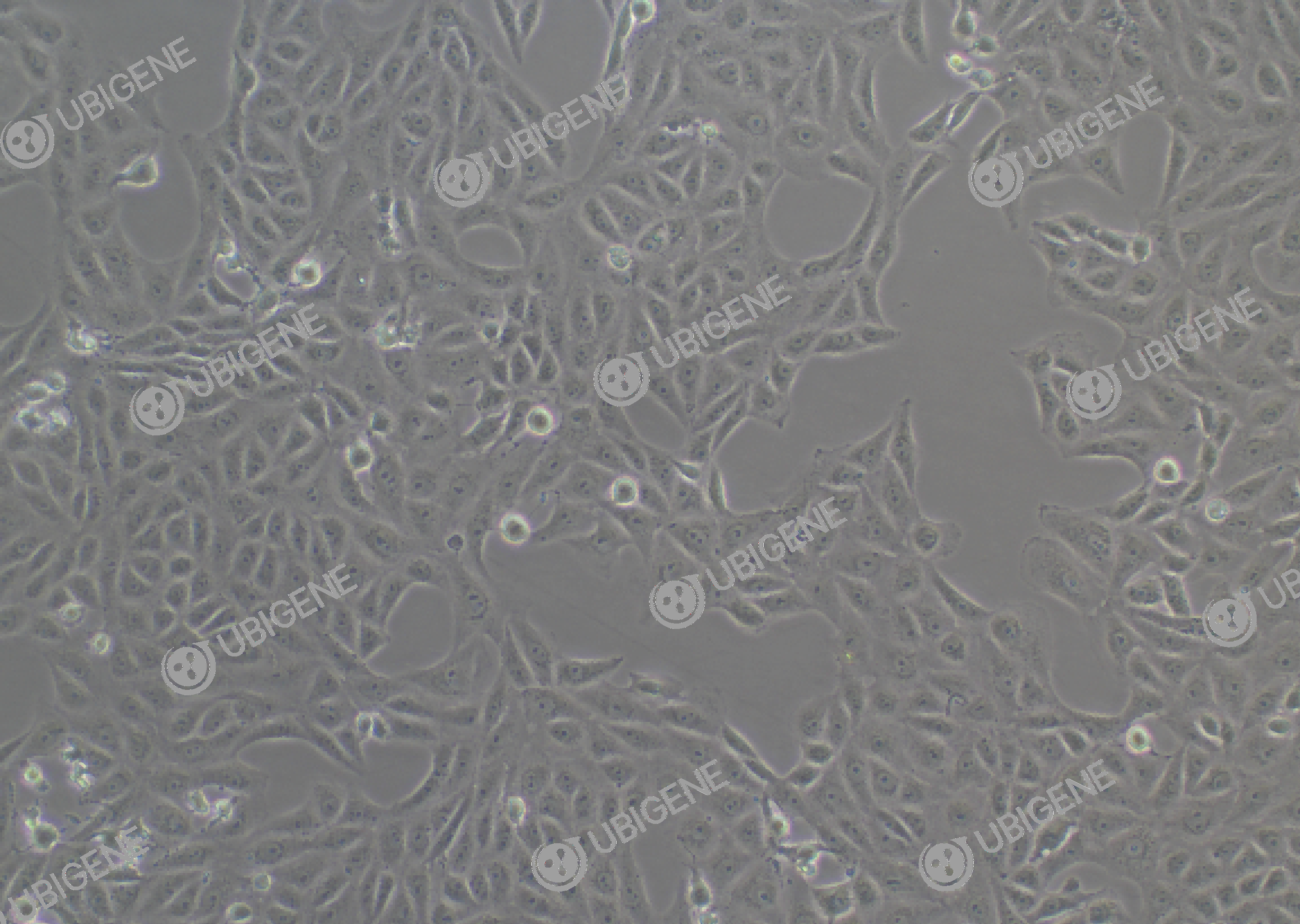 非洲绿猴肾细胞(Vero)细胞形态培养图