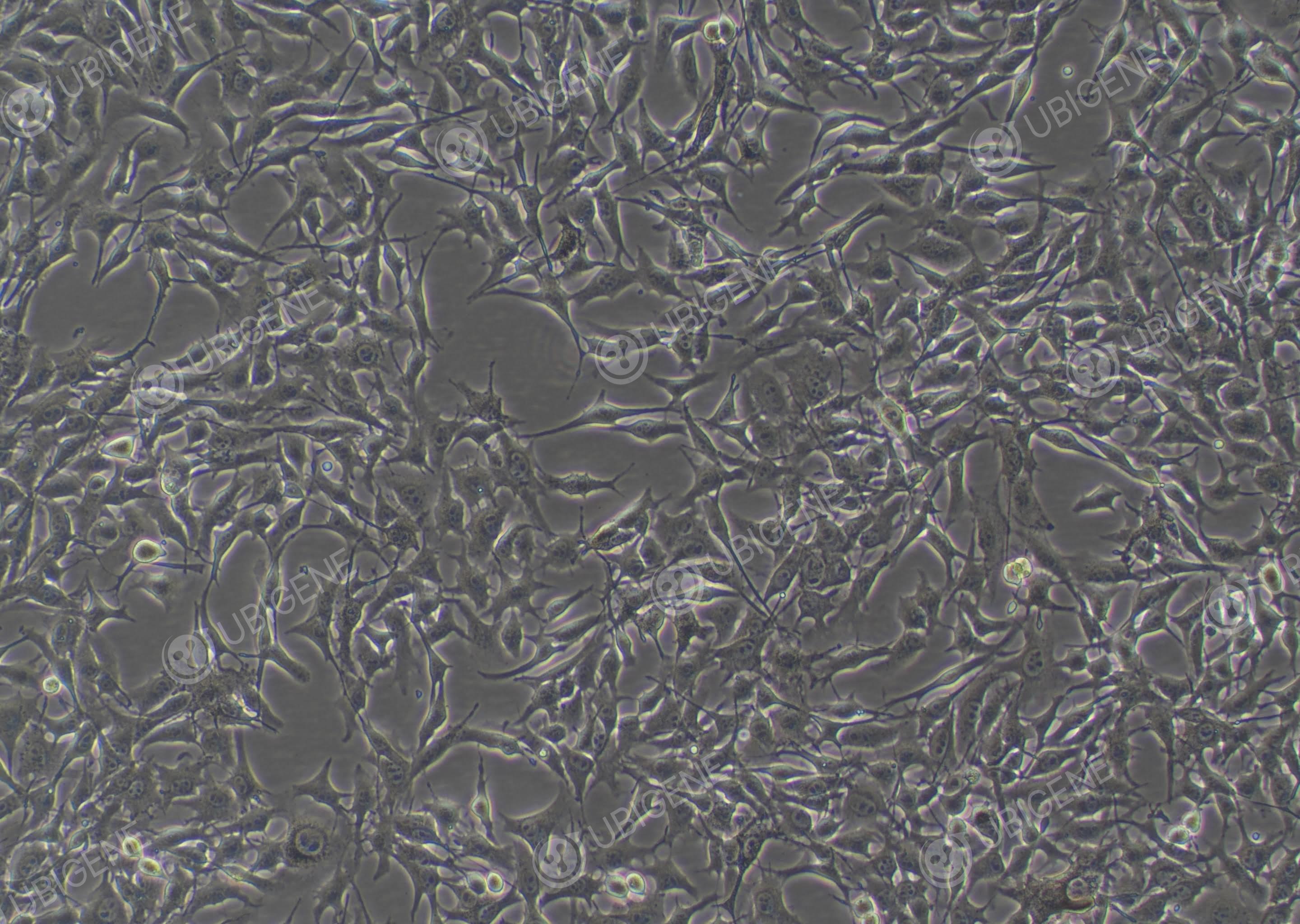 小鼠皮肤黑色素瘤细胞(B16-F10-EGFP)-B16-F10