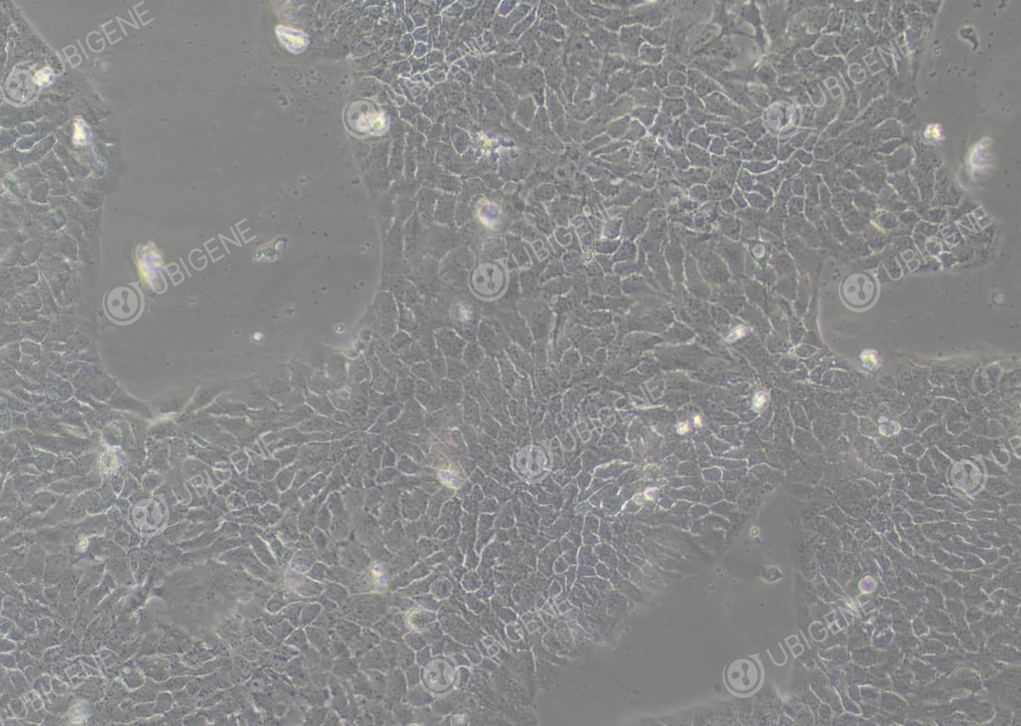 人表皮癌细胞(A-431-Luc)-A-431-Luc