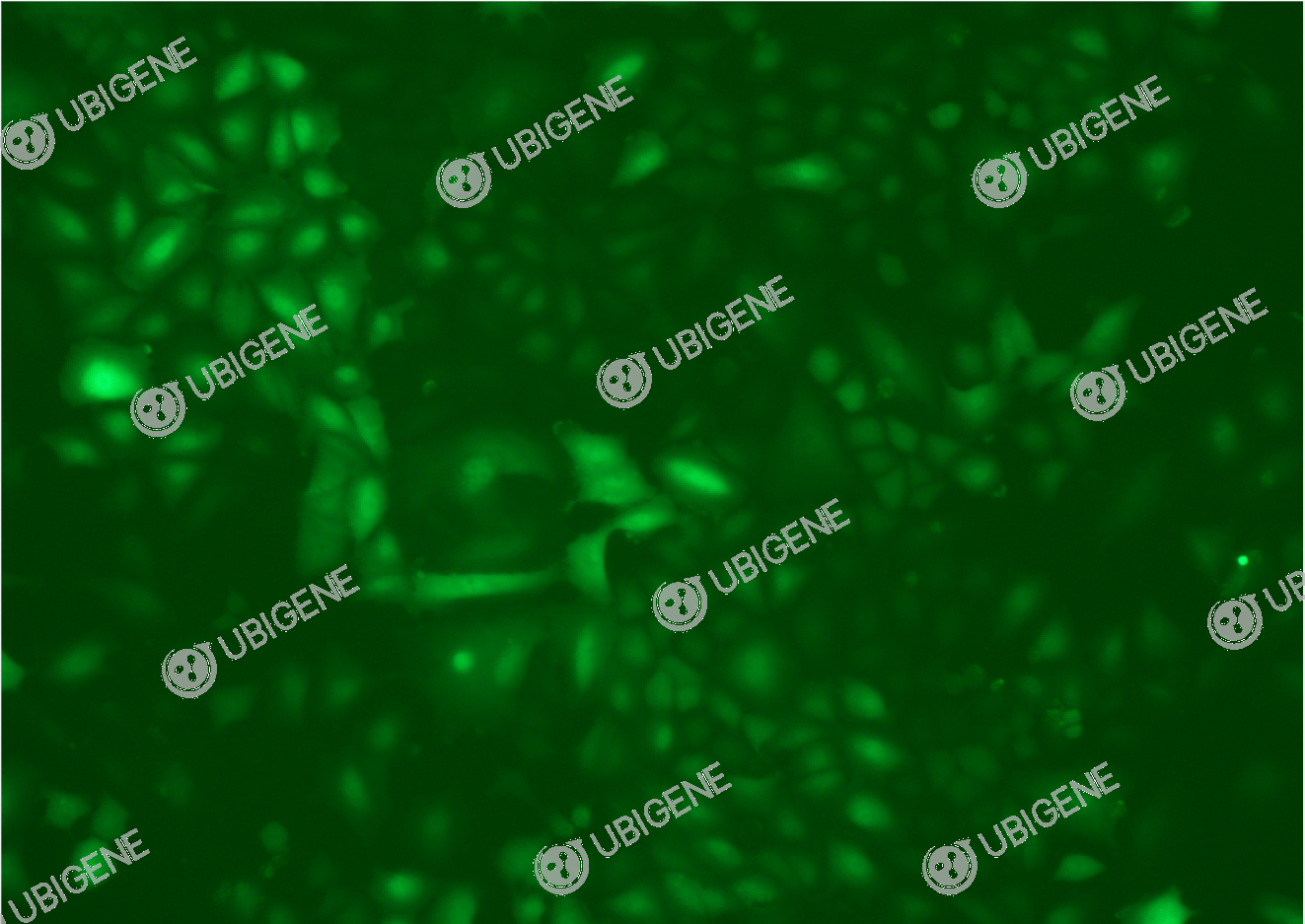 TXNIP Stable Expression Cell Line (A549)-细胞图0