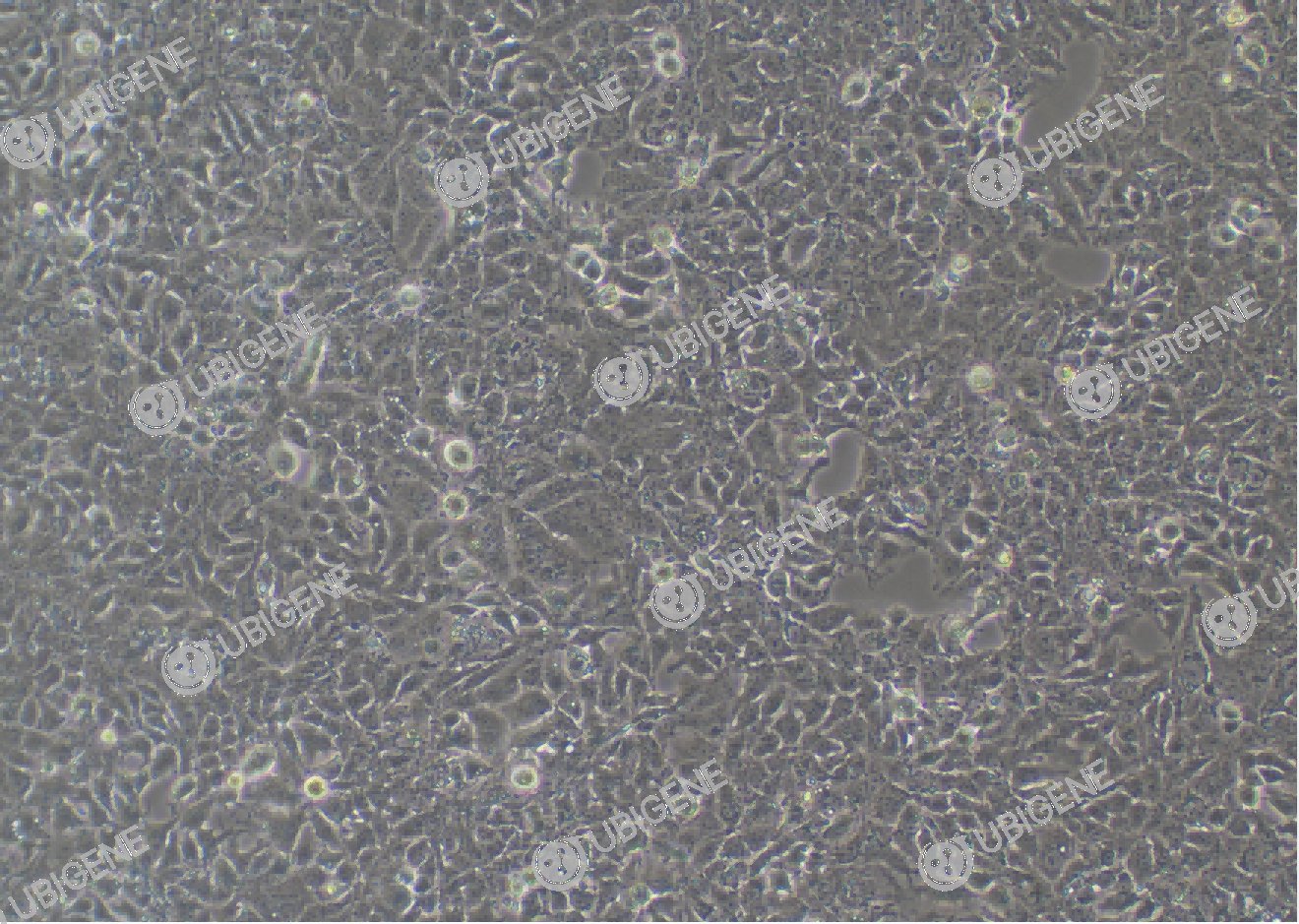 CSF2 Stable Expression Cell Line (HuH-7)-细胞图1
