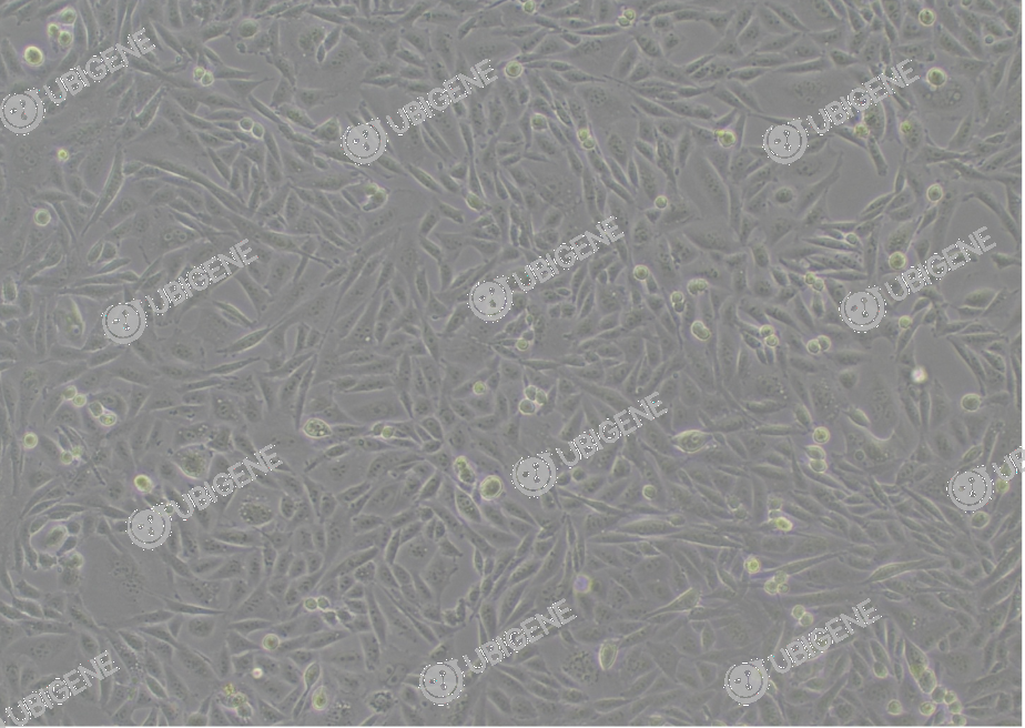 CYP11B1 Stable Expression Cell Line (V79)-细胞图1