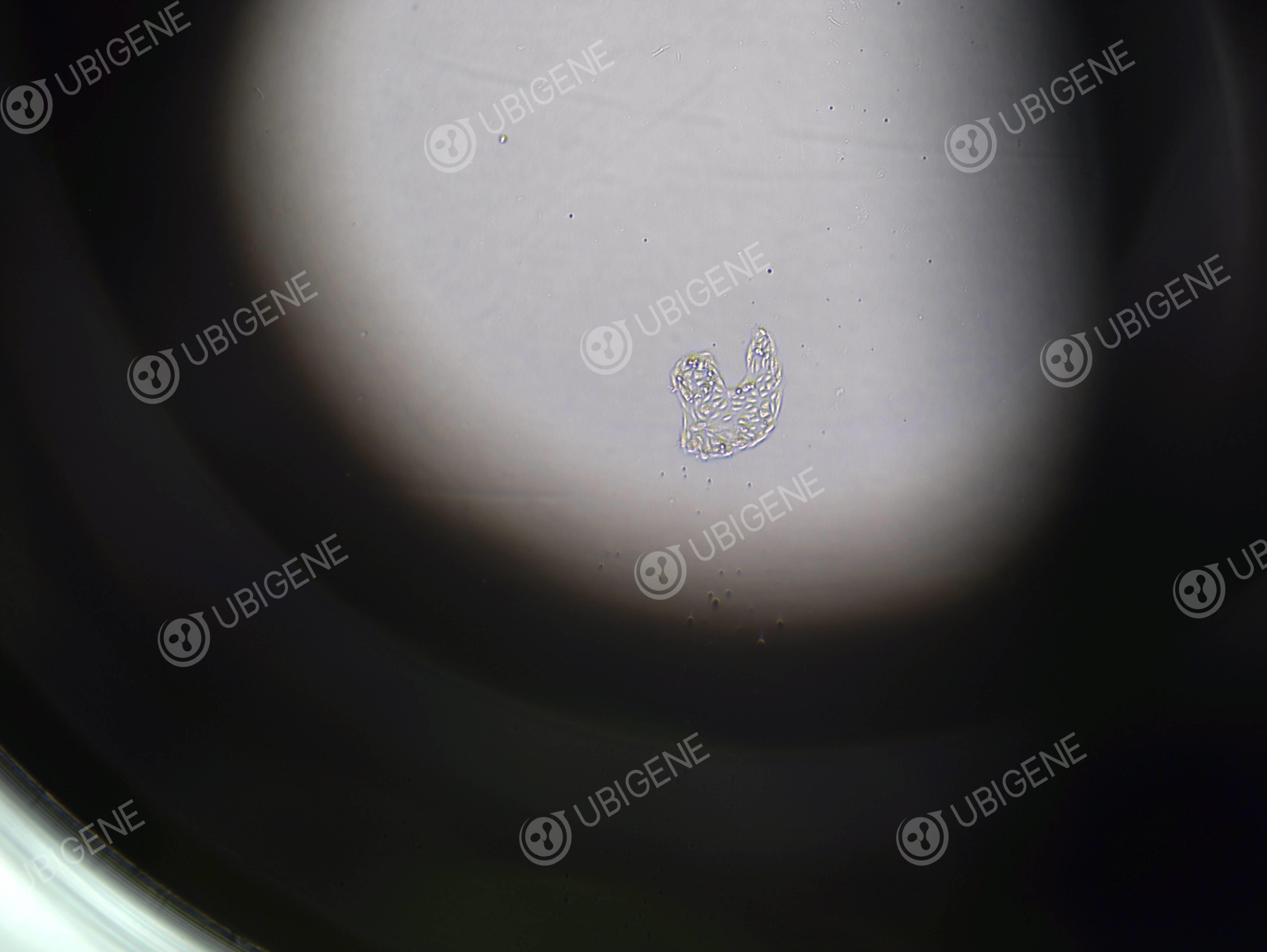 人肾细胞腺癌细胞(ACHN-EGFP)-单克隆