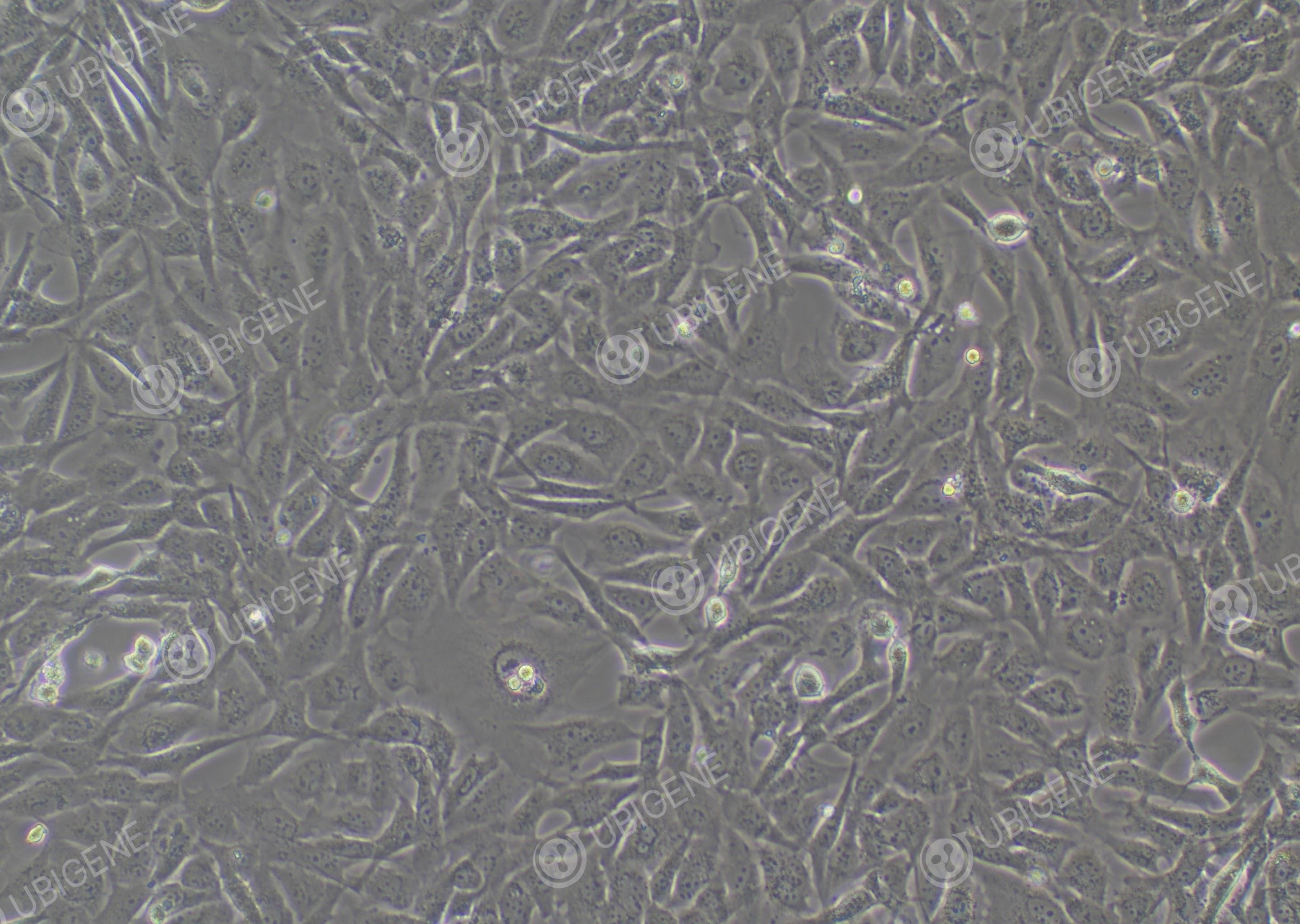 BEAS-2B cell line | Ubigene