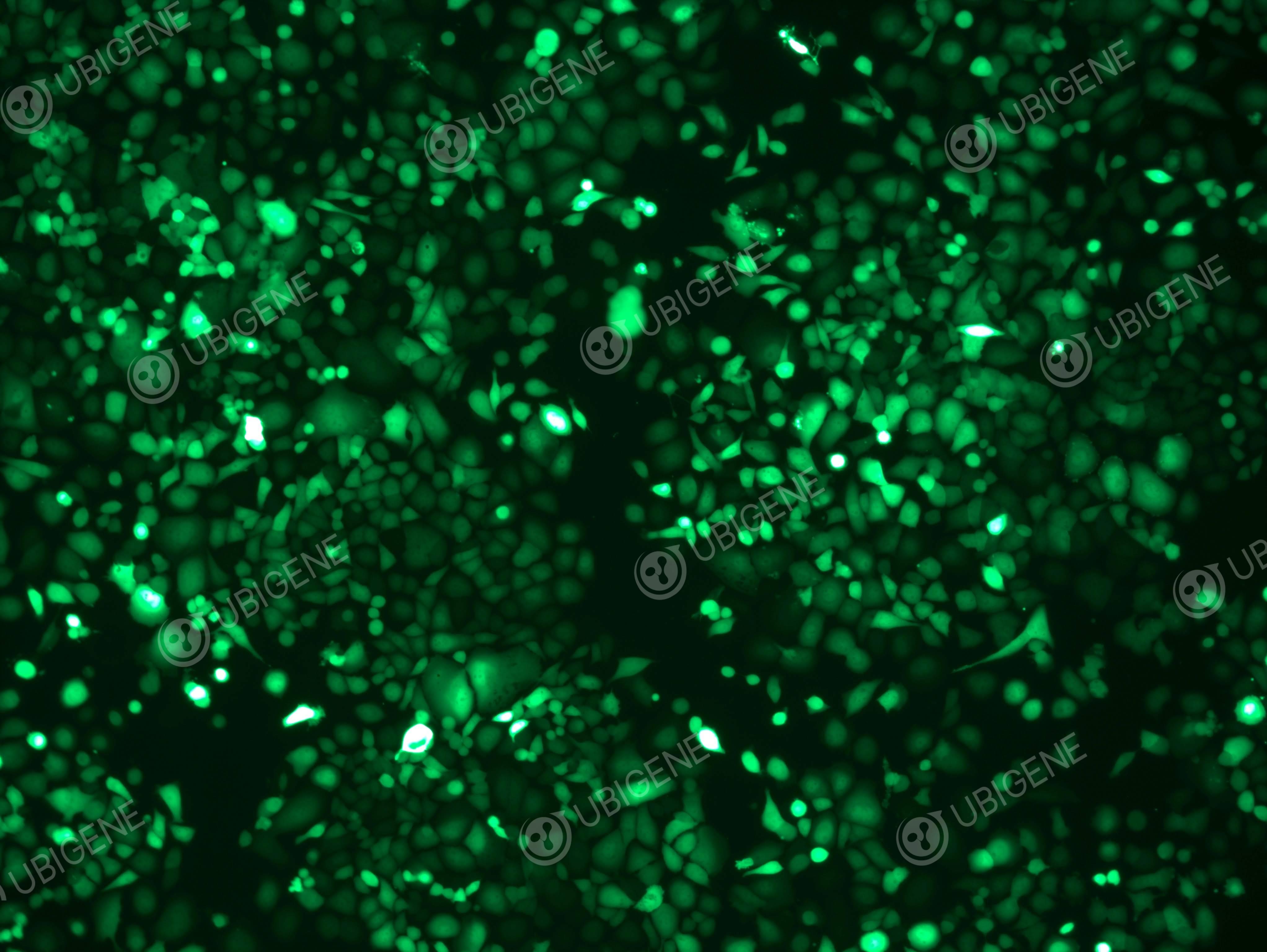 人非小细胞肺癌细胞(NCI-H23-Luc)-转染图